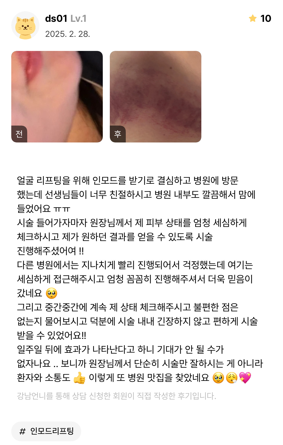 Review - 디온의원 선릉점 10