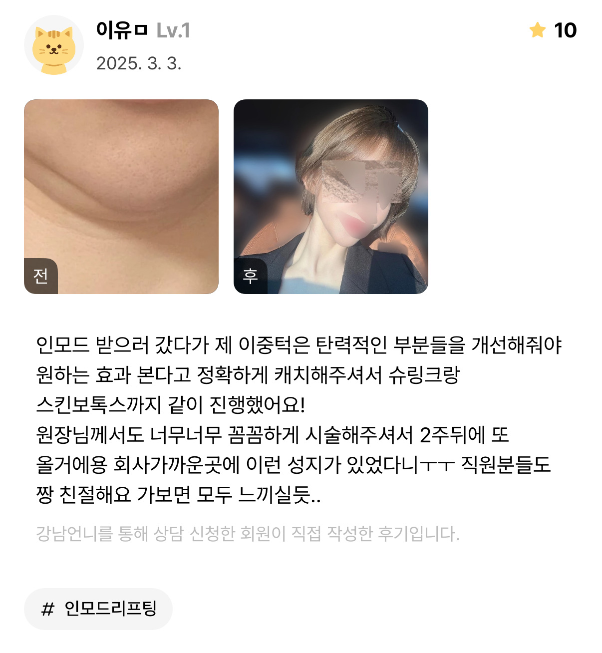 Review - 디온의원 선릉점 3