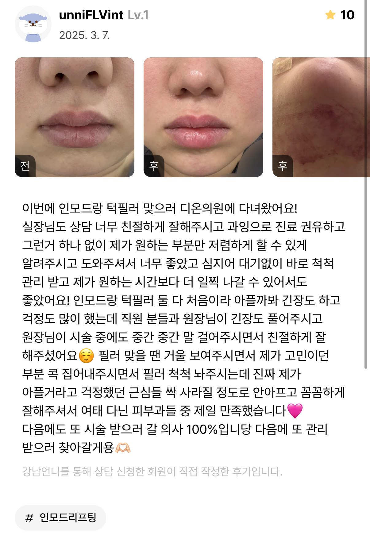 Review - 디온의원 선릉점 5