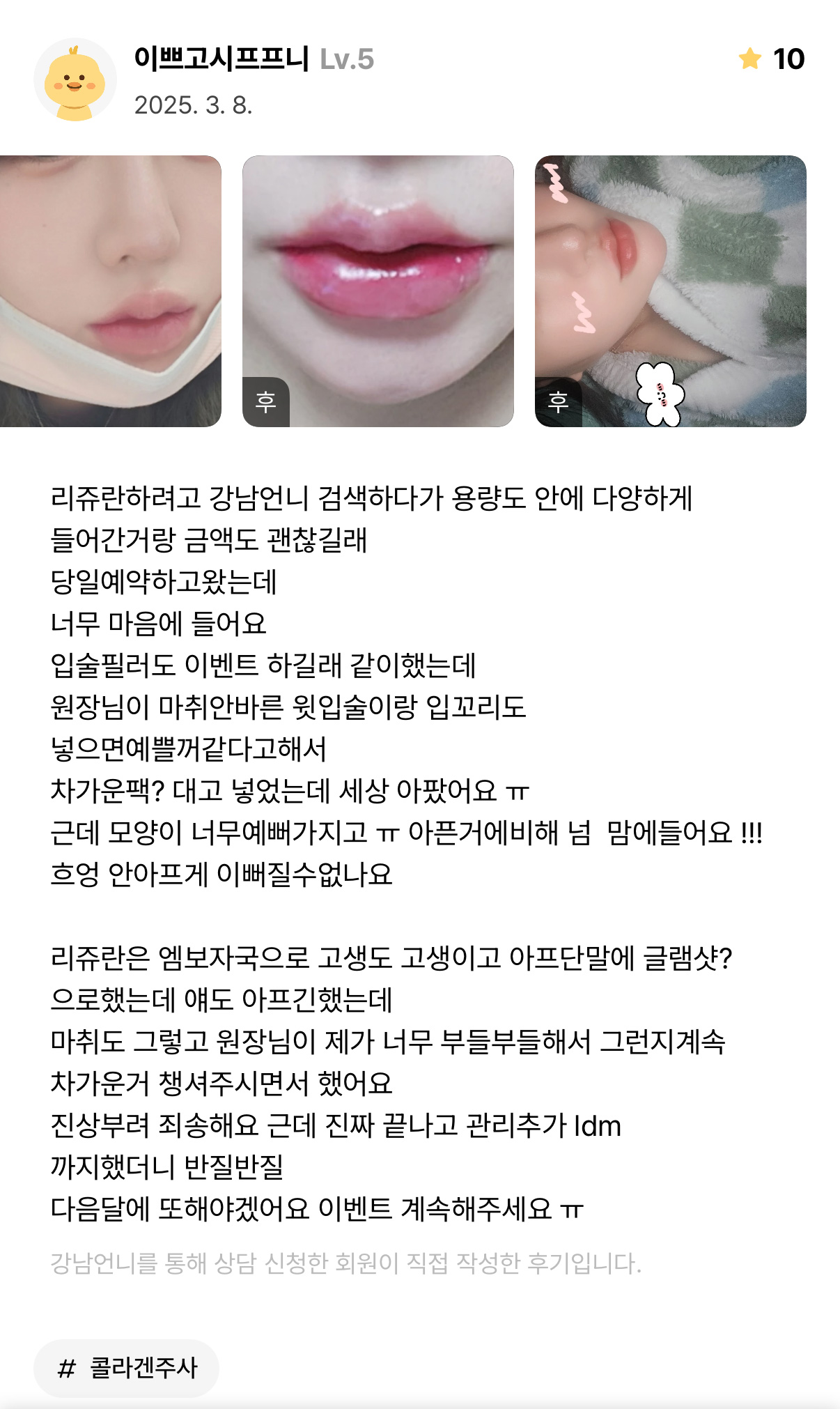 Review - 디온의원 선릉점 7