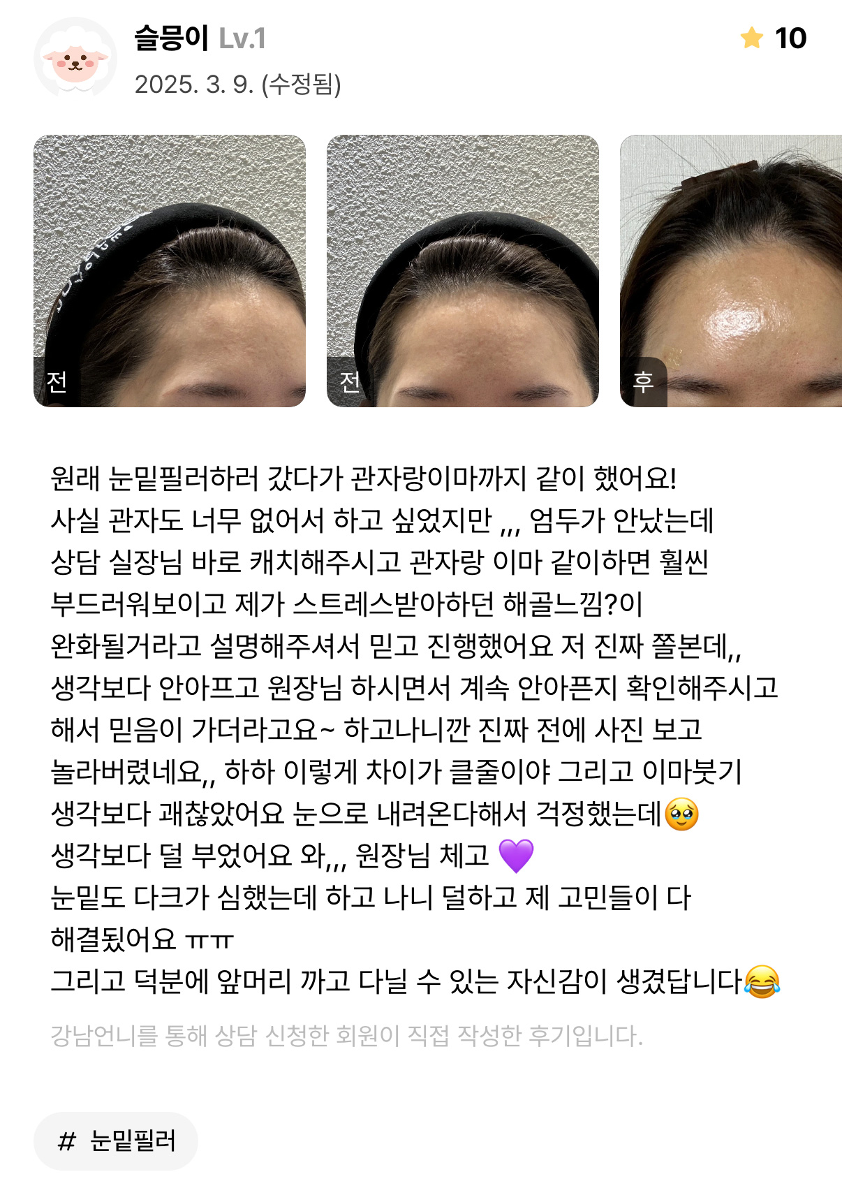 Review - 디온의원 선릉점 8