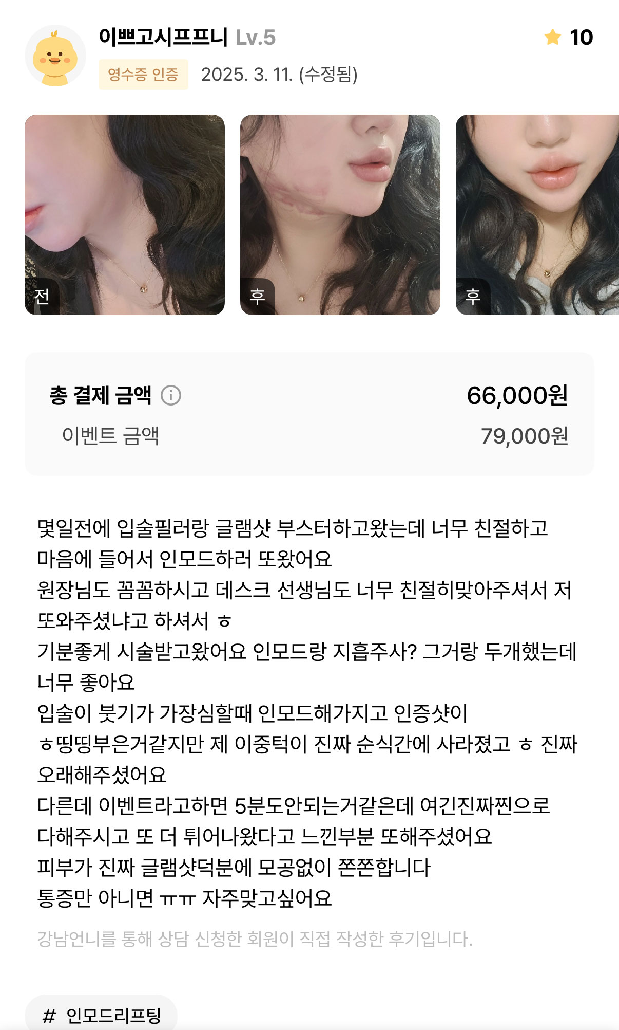 Review - 디온의원 선릉점 5