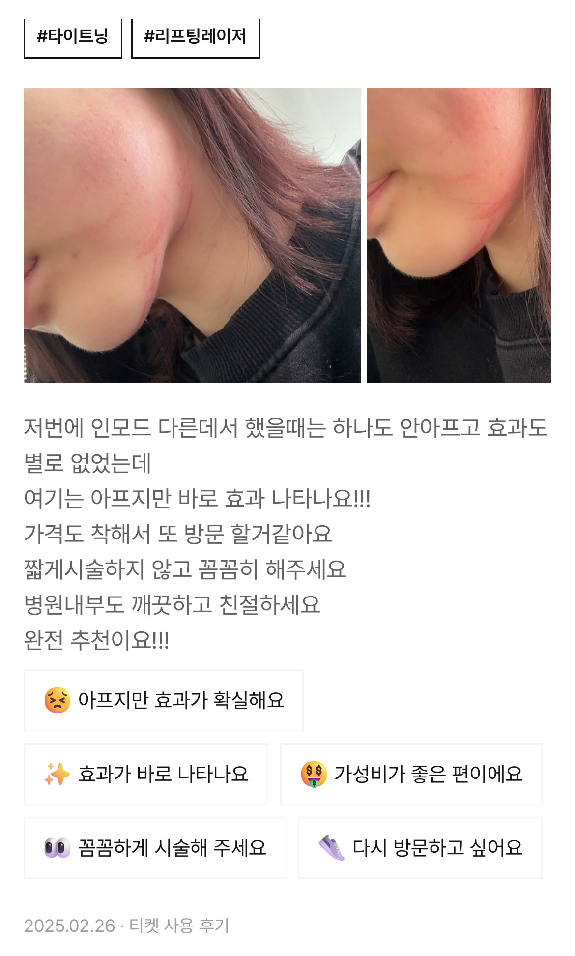 Review - 디온의원 선릉점 9