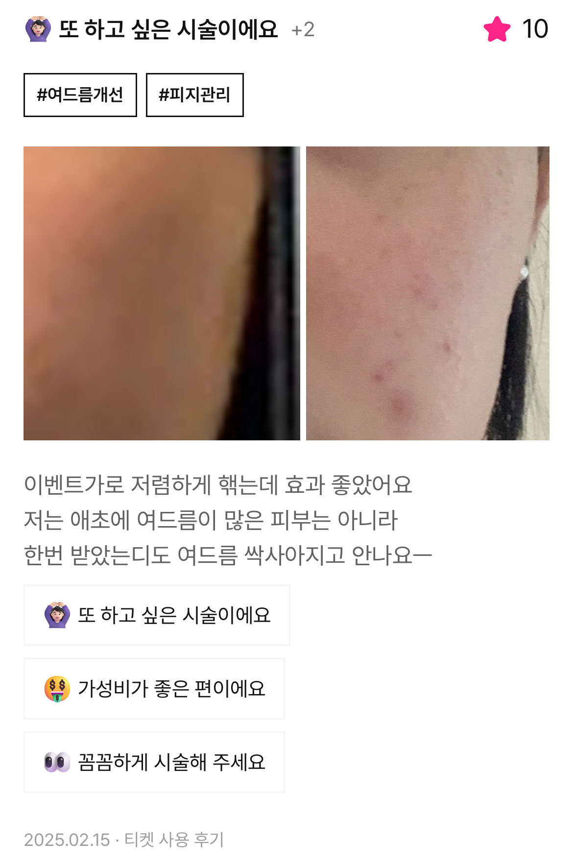 Review - 디온의원 선릉점 3