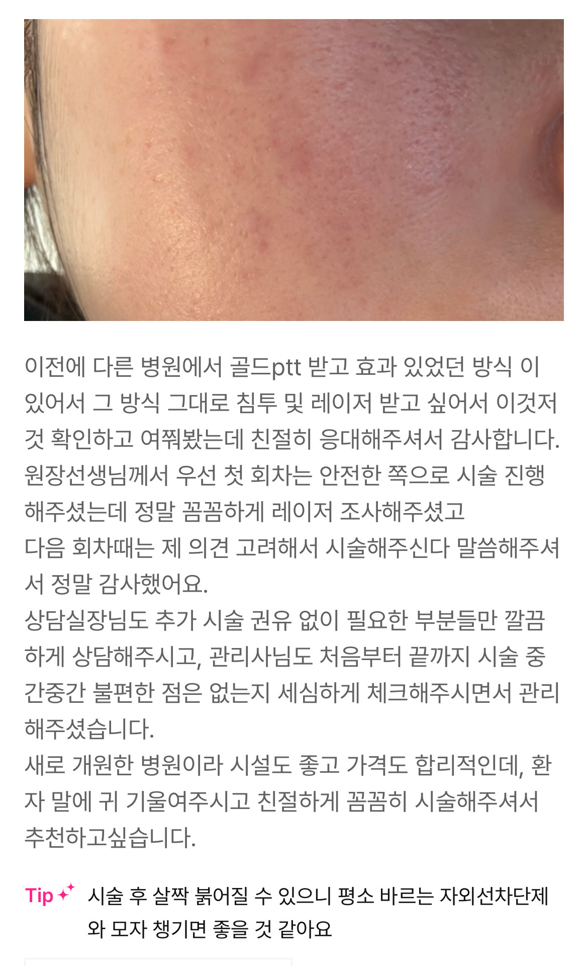 Review - 디온의원 선릉점 3