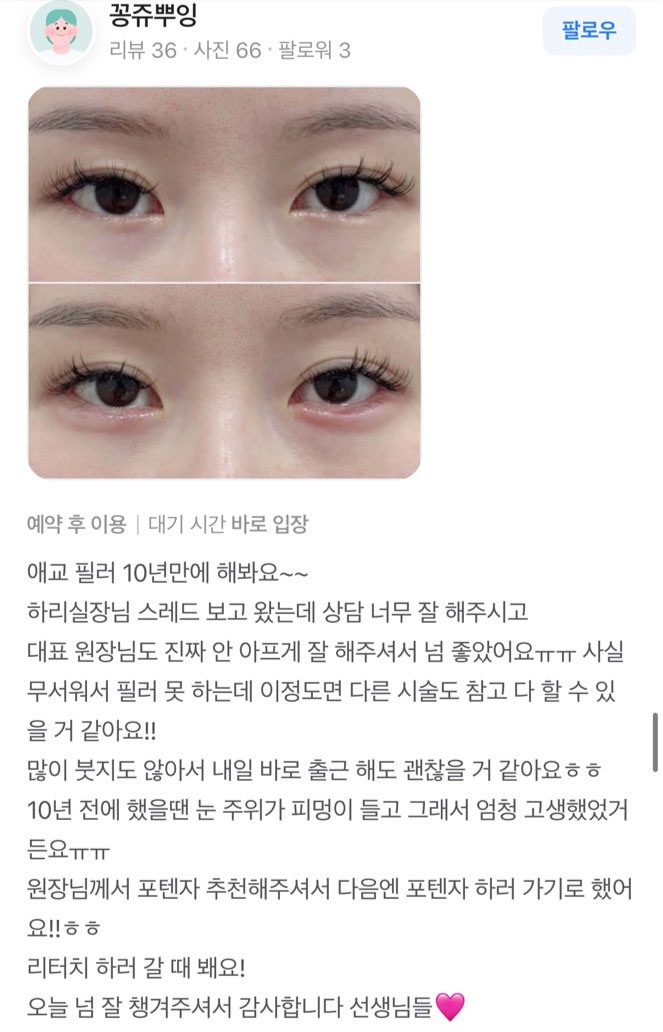 Review - 디온의원 선릉점 10