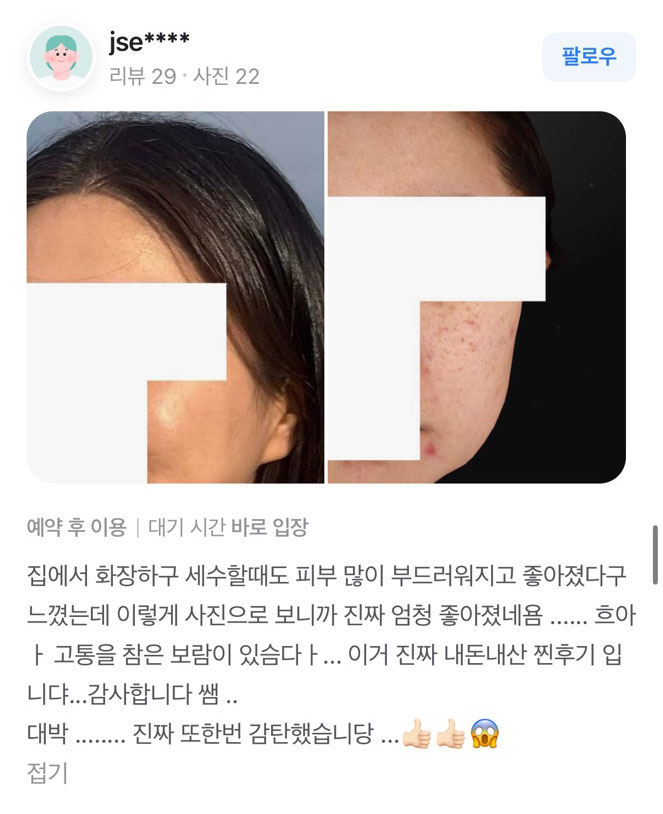 Review - 디온의원 선릉점 4