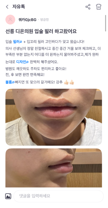 KakaoTalk 20250414 120418529 - 디온의원 선릉점