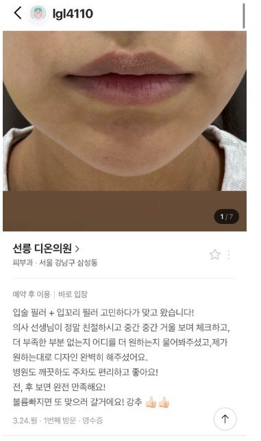 KakaoTalk 20250414 120421528 - 디온의원 선릉점