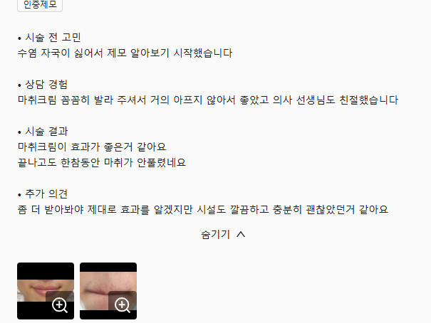 Review - 디온의원 선릉점 5