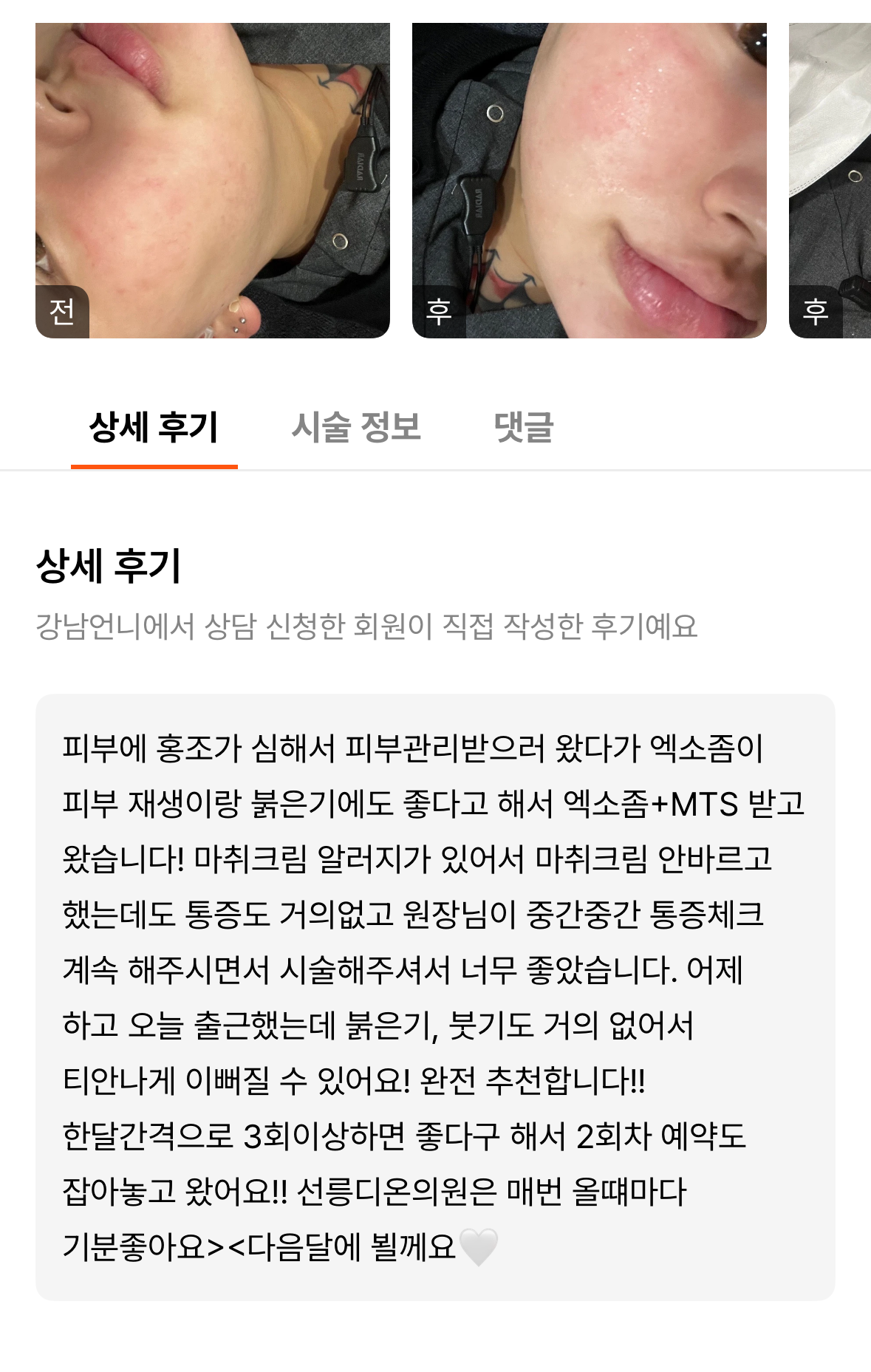 Review - 디온의원 선릉점 9