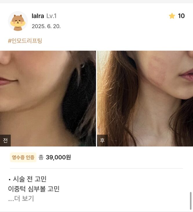 KakaoTalk 20250711 150832373 e1752563626229 - 디온의원 선릉점