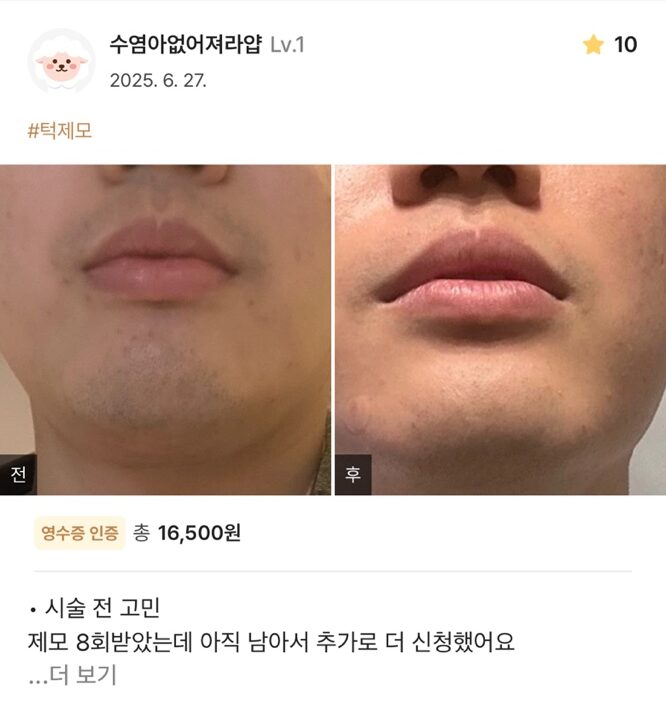 KakaoTalk 20250711 150832373 03 e1752563666292 - 디온의원 선릉점