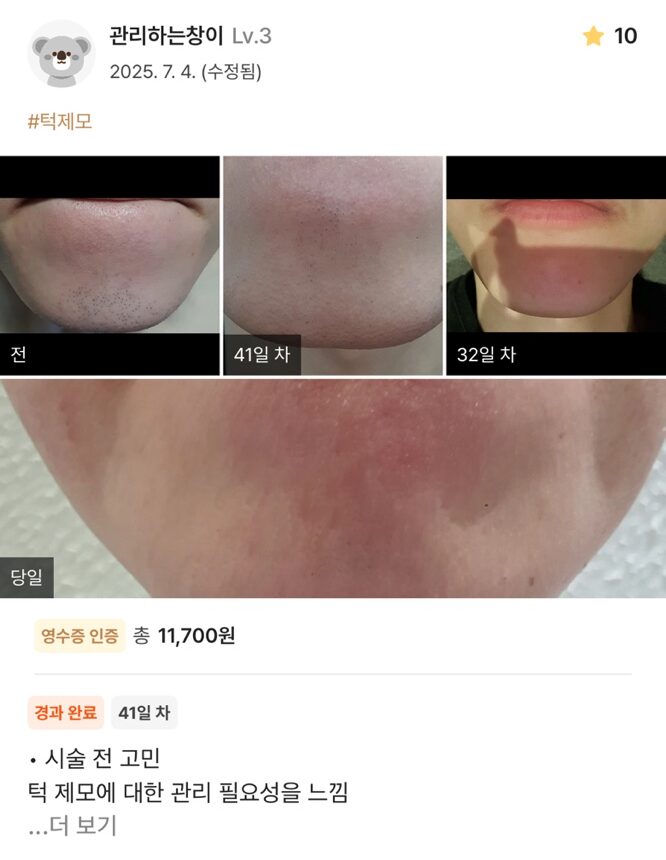 KakaoTalk 20250711 150832373 05 e1752563687225 - 디온의원 선릉점