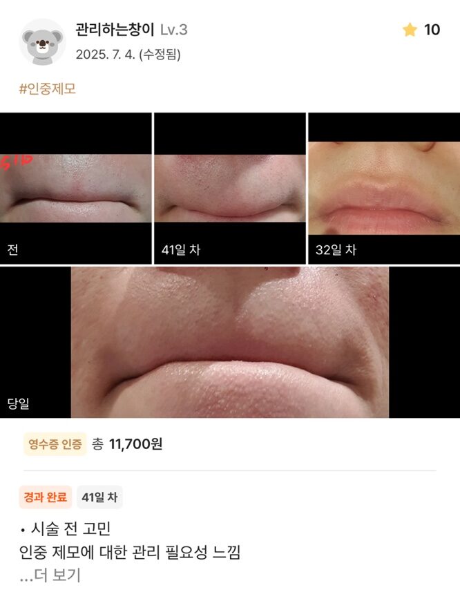 KakaoTalk 20250711 150832373 06 e1752563696127 - 디온의원 선릉점