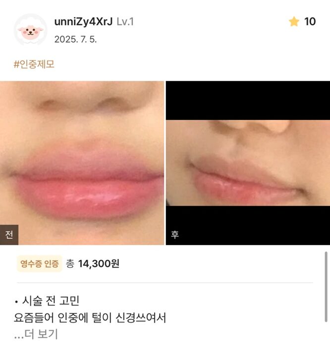 KakaoTalk 20250711 150832373 07 e1752563708620 - 디온의원 선릉점