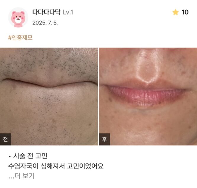 KakaoTalk 20250711 150832373 08 e1752563719637 - 디온의원 선릉점