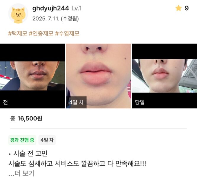 KakaoTalk 20250711 150832373 10 e1752563738771 - 디온의원 선릉점