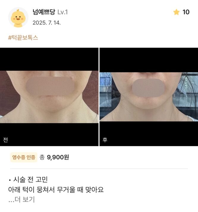 re 13 e1754534742174 - 디온의원 선릉점