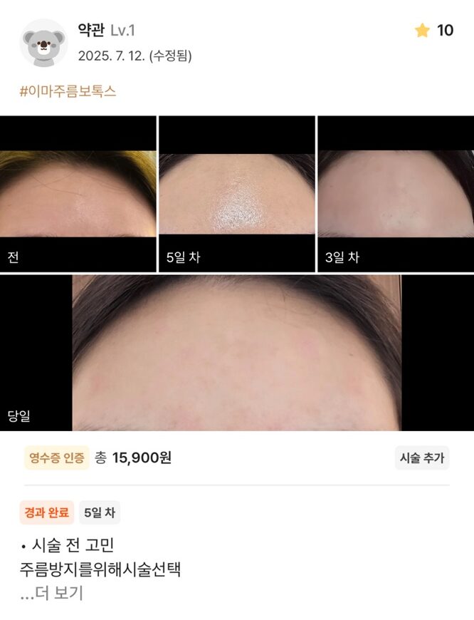 re 15 e1754534755237 - 디온의원 선릉점