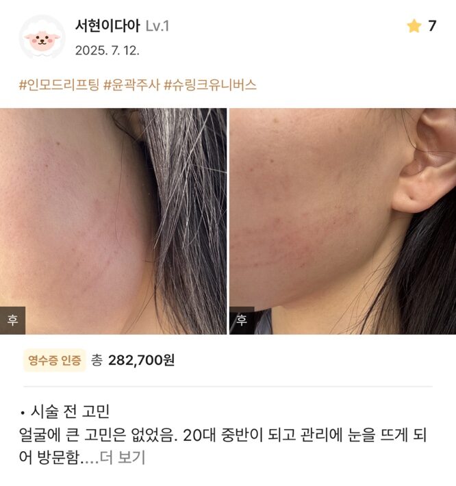 re 17 e1754534768661 - 디온의원 선릉점