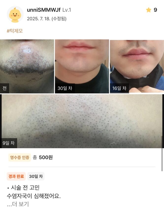 re 19 e1754534779758 - 디온의원 선릉점