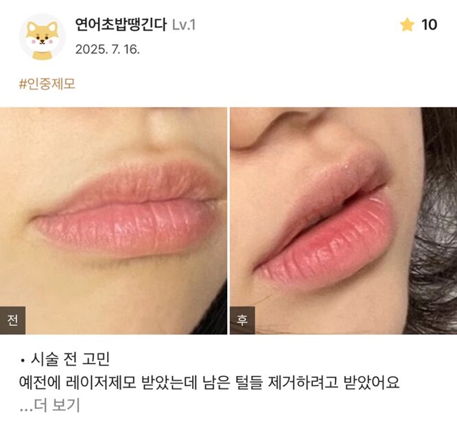 re 21 e1754534791106 - 디온의원 선릉점