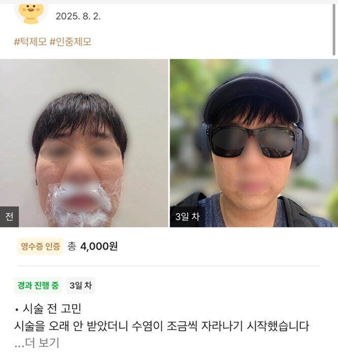 re 25 e1754534724501 - 디온의원 선릉점