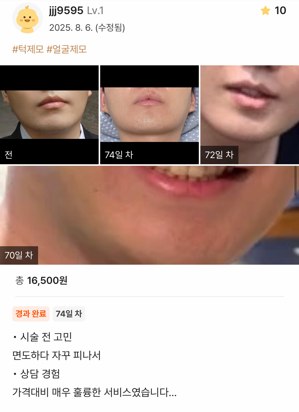 Review - 디온의원 선릉점 9