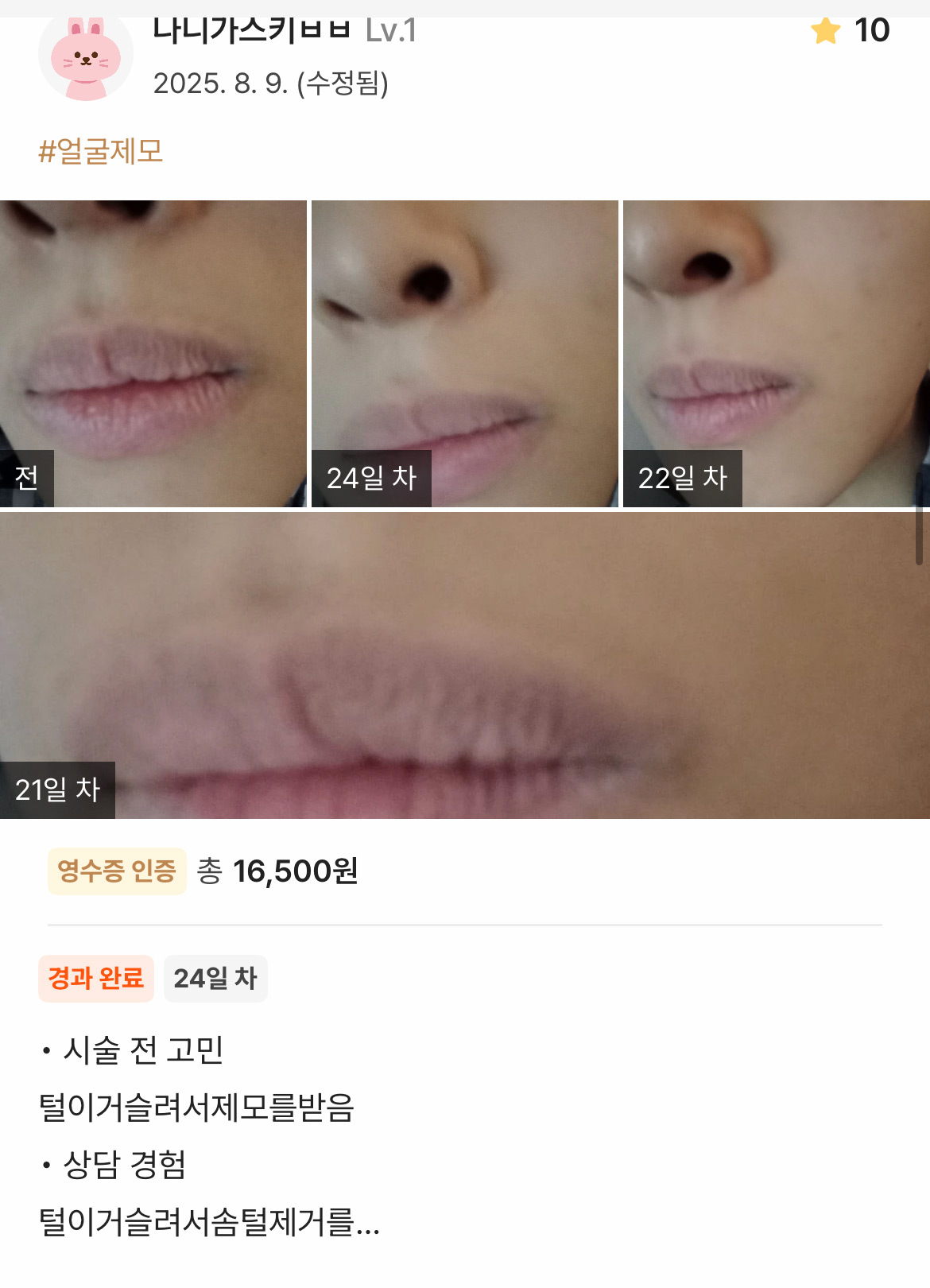 Review - 디온의원 선릉점 8