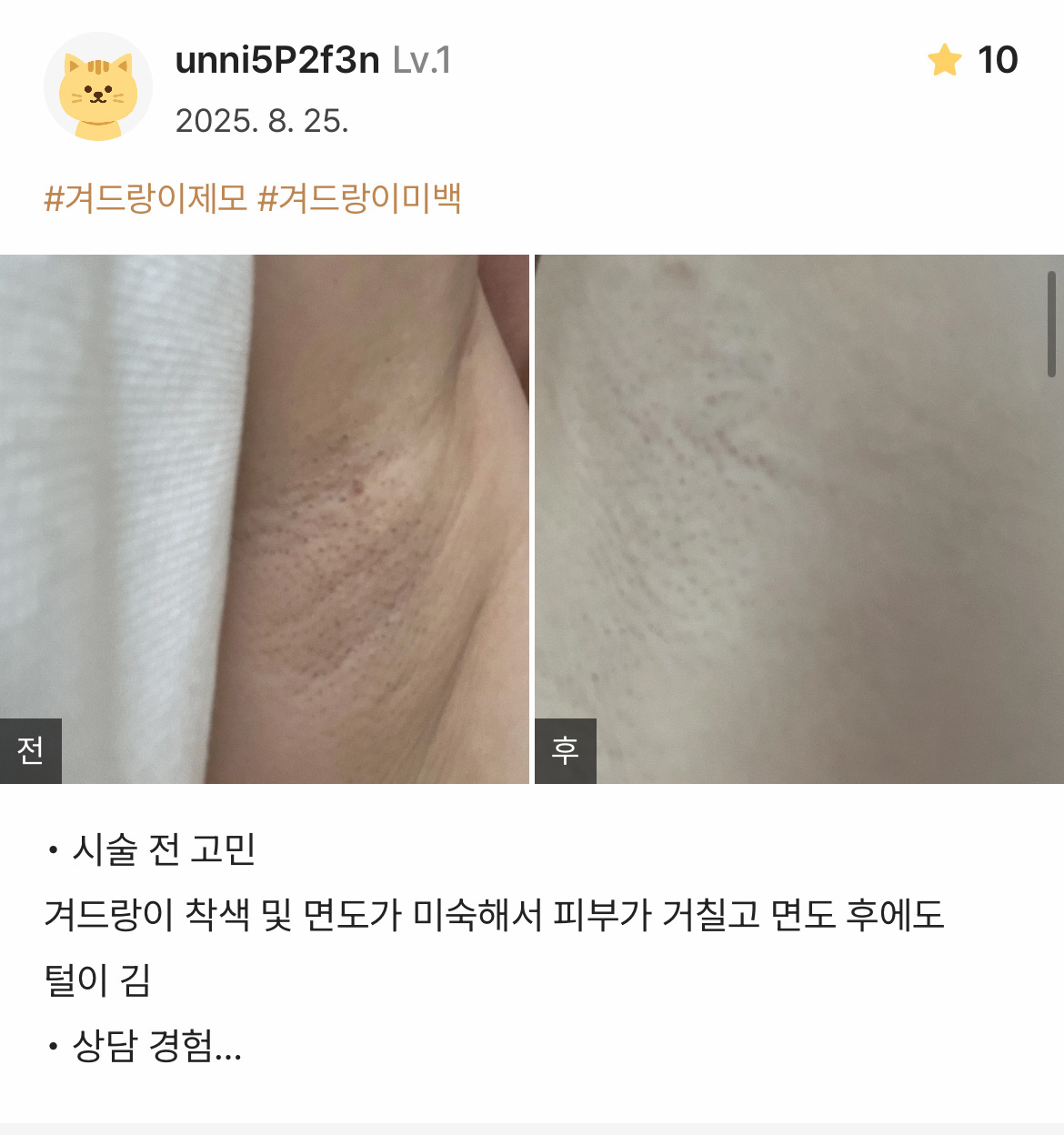 Review - 디온의원 선릉점 7