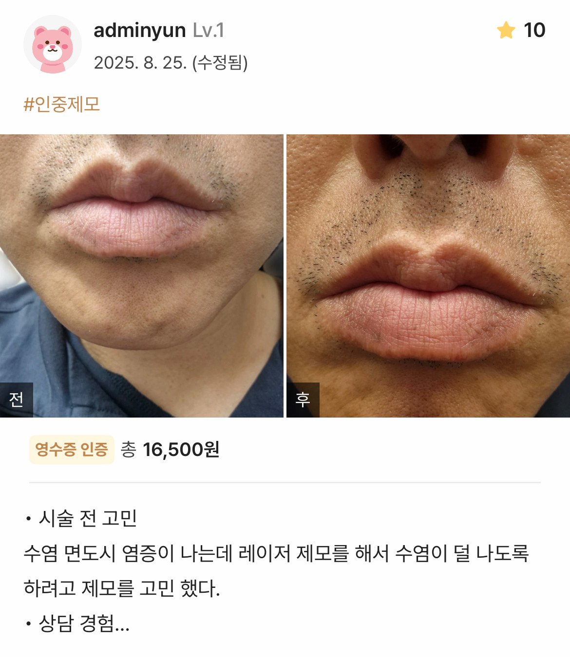 Review - 디온의원 선릉점 6