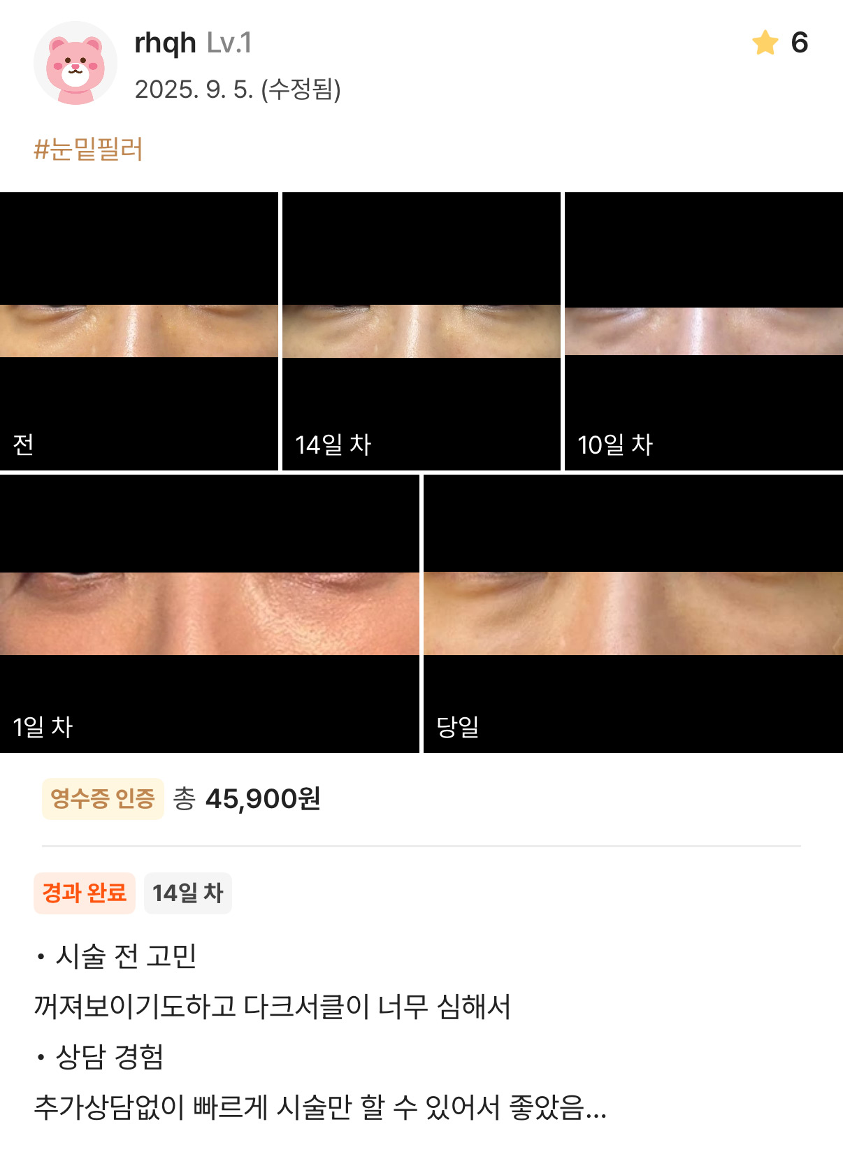 Review - 디온의원 선릉점 4