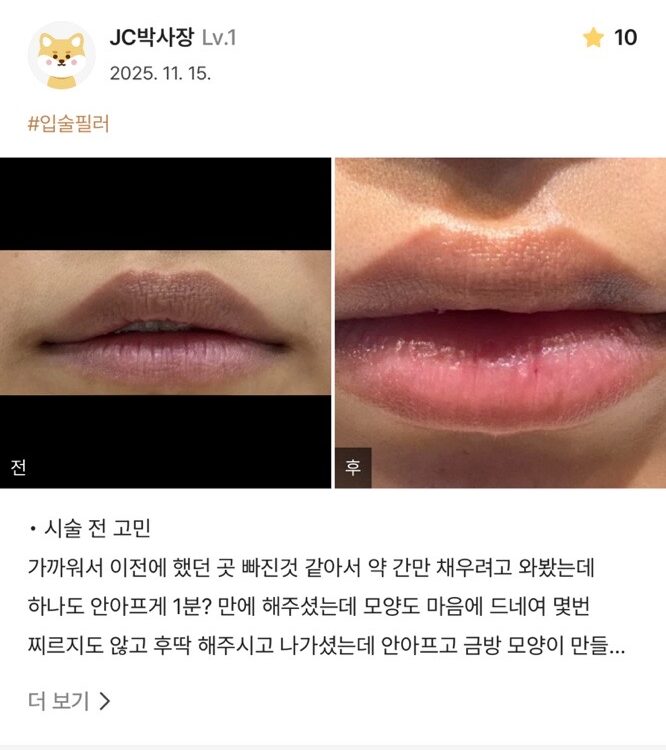 KakaoTalk 20251203 165715251 e1765507433429 - 디온의원 선릉점