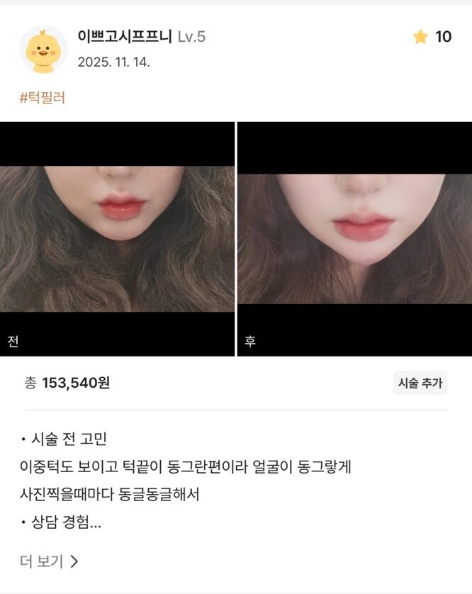 KakaoTalk 20251203 165715251 01 e1765507463681 - 디온의원 선릉점