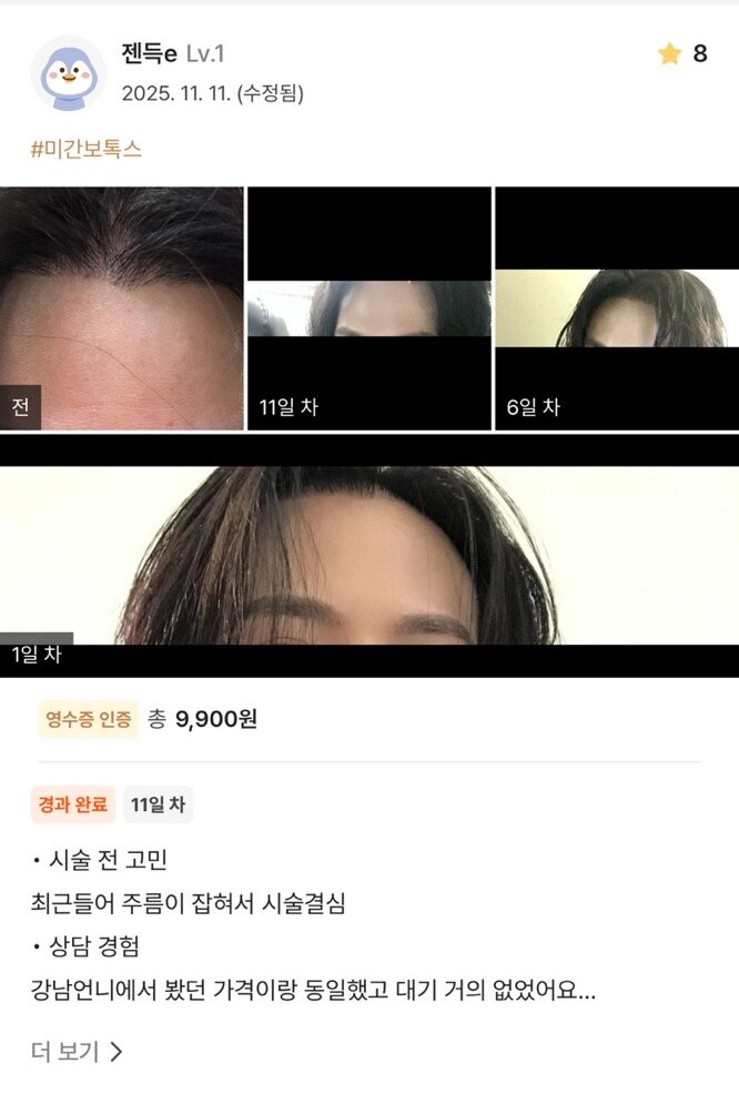 KakaoTalk 20251203 165715251 02 e1765507494254 - 디온의원 선릉점