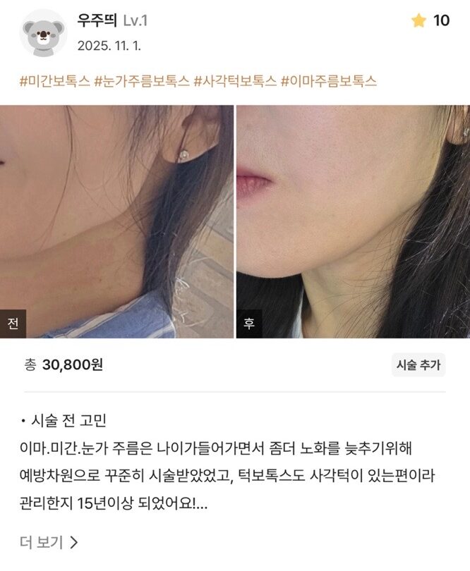 KakaoTalk 20251203 165715251 03 e1765507533508 - 디온의원 선릉점