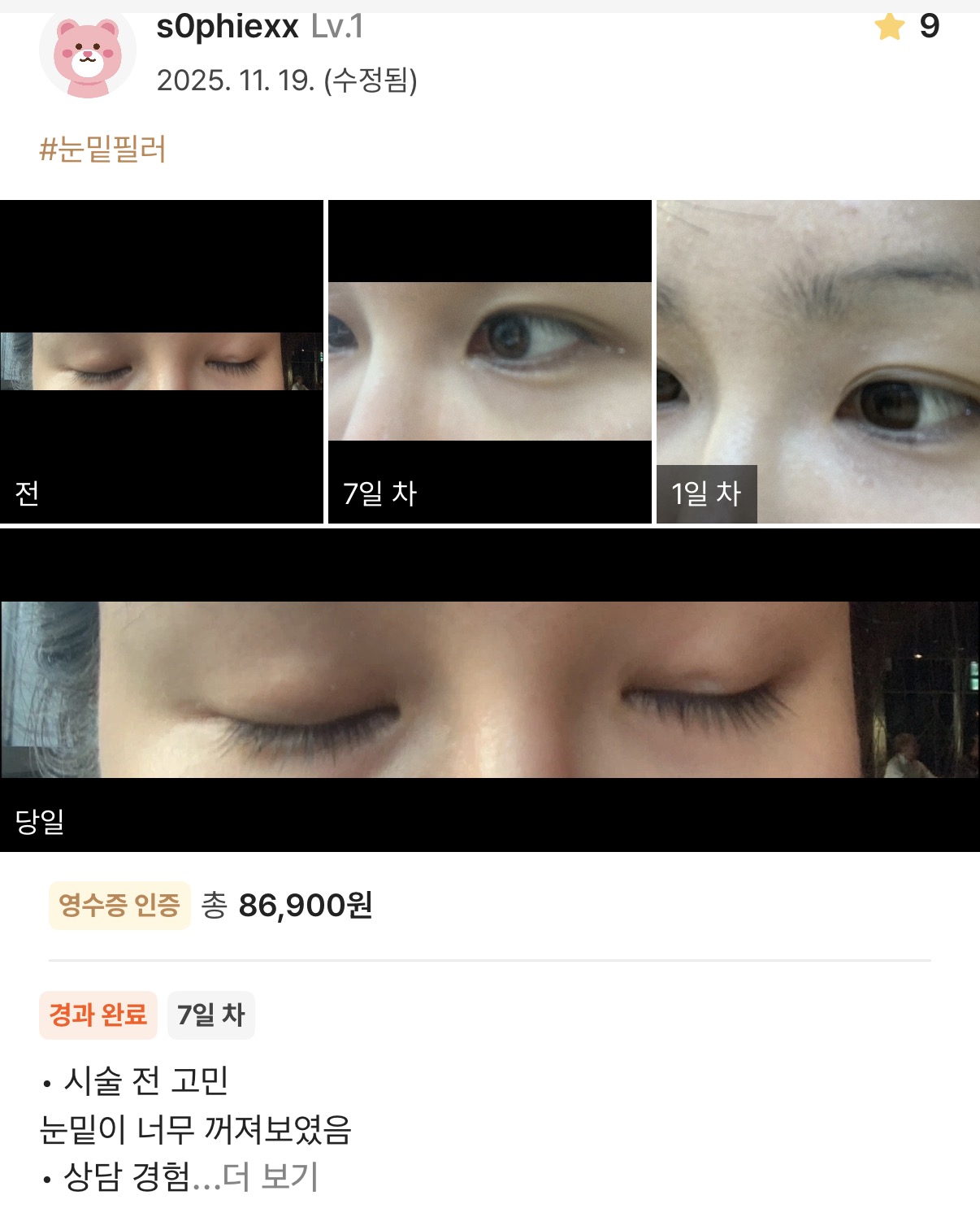 KakaoTalk 20251203 171813414 - 디온의원 선릉점