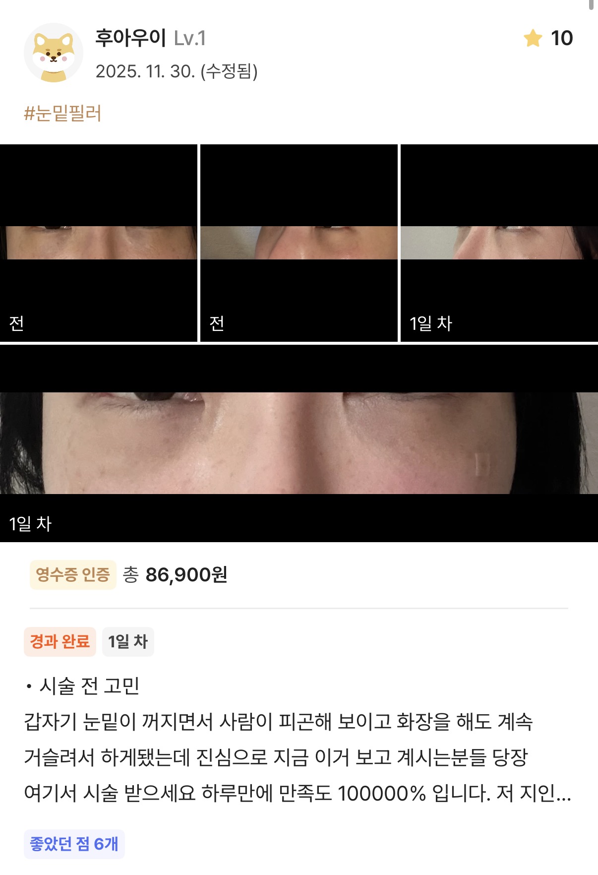 KakaoTalk 20251203 171813414 02 - 디온의원 선릉점