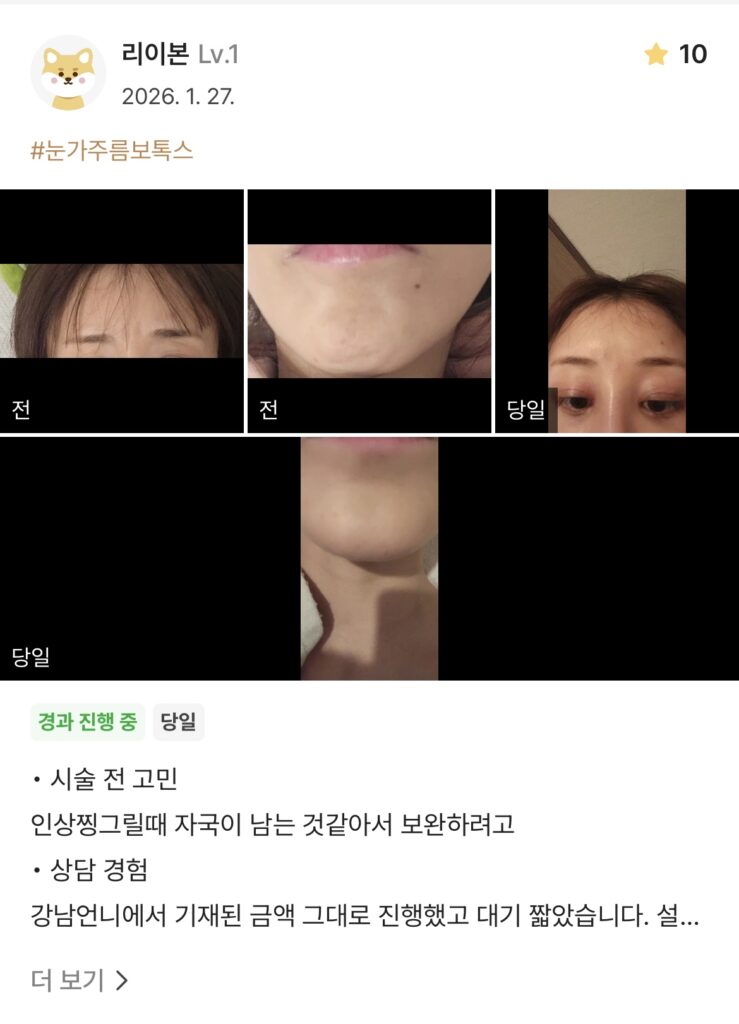 Coming soon - 디온의원 선릉점 3