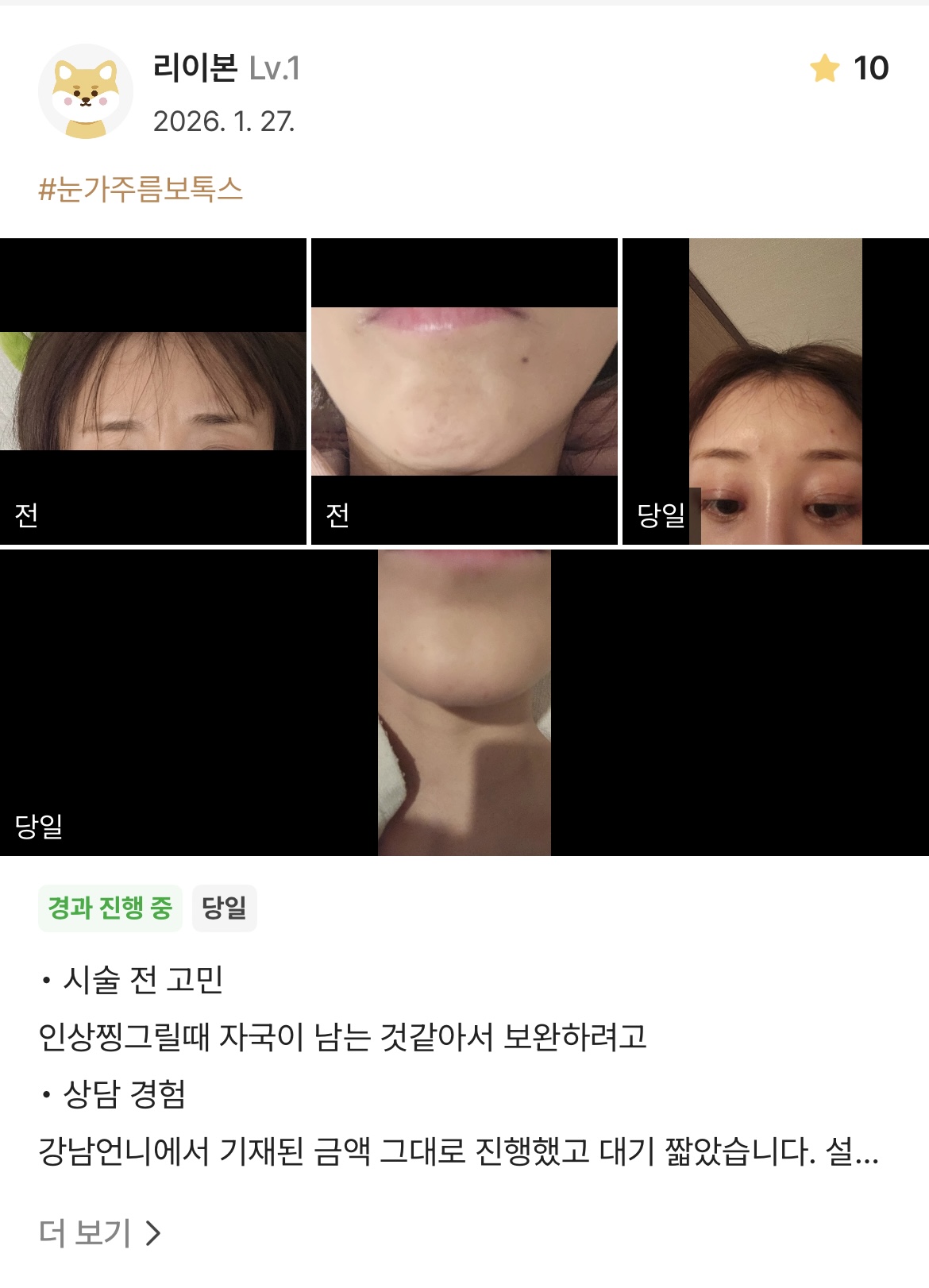 Review - 디온의원 선릉점 9