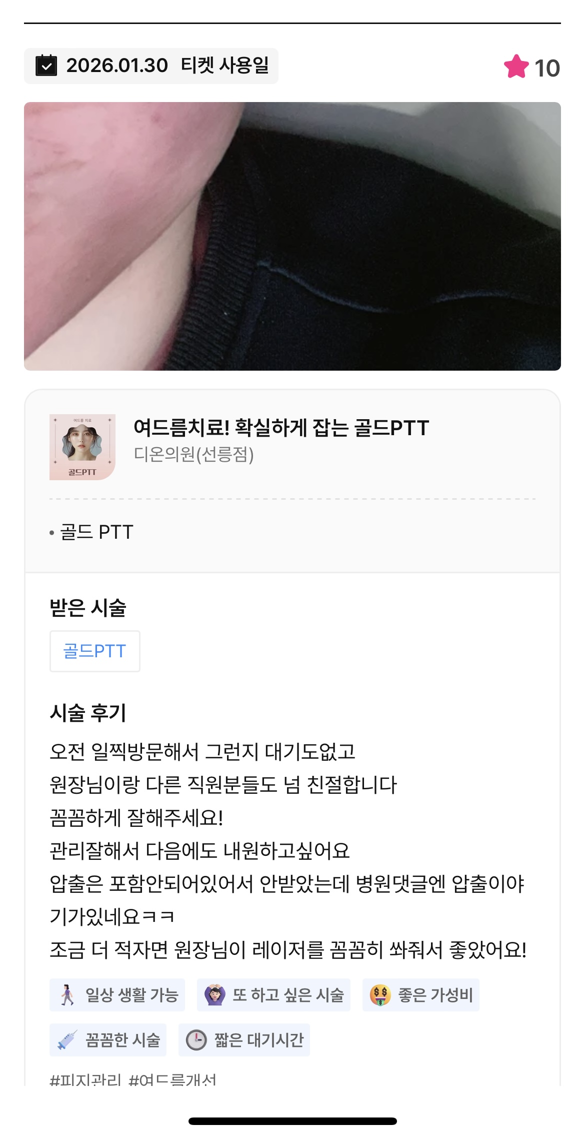 Review - 디온의원 선릉점 9