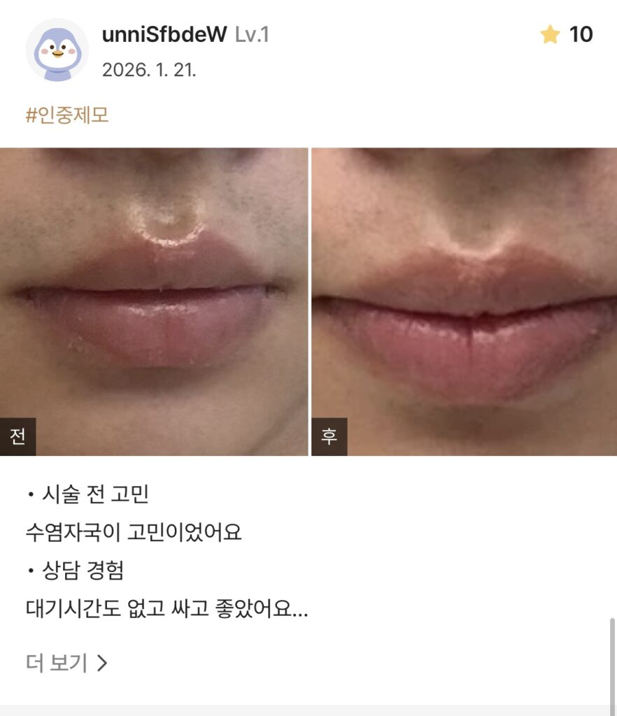Coming soon - 디온의원 선릉점 4