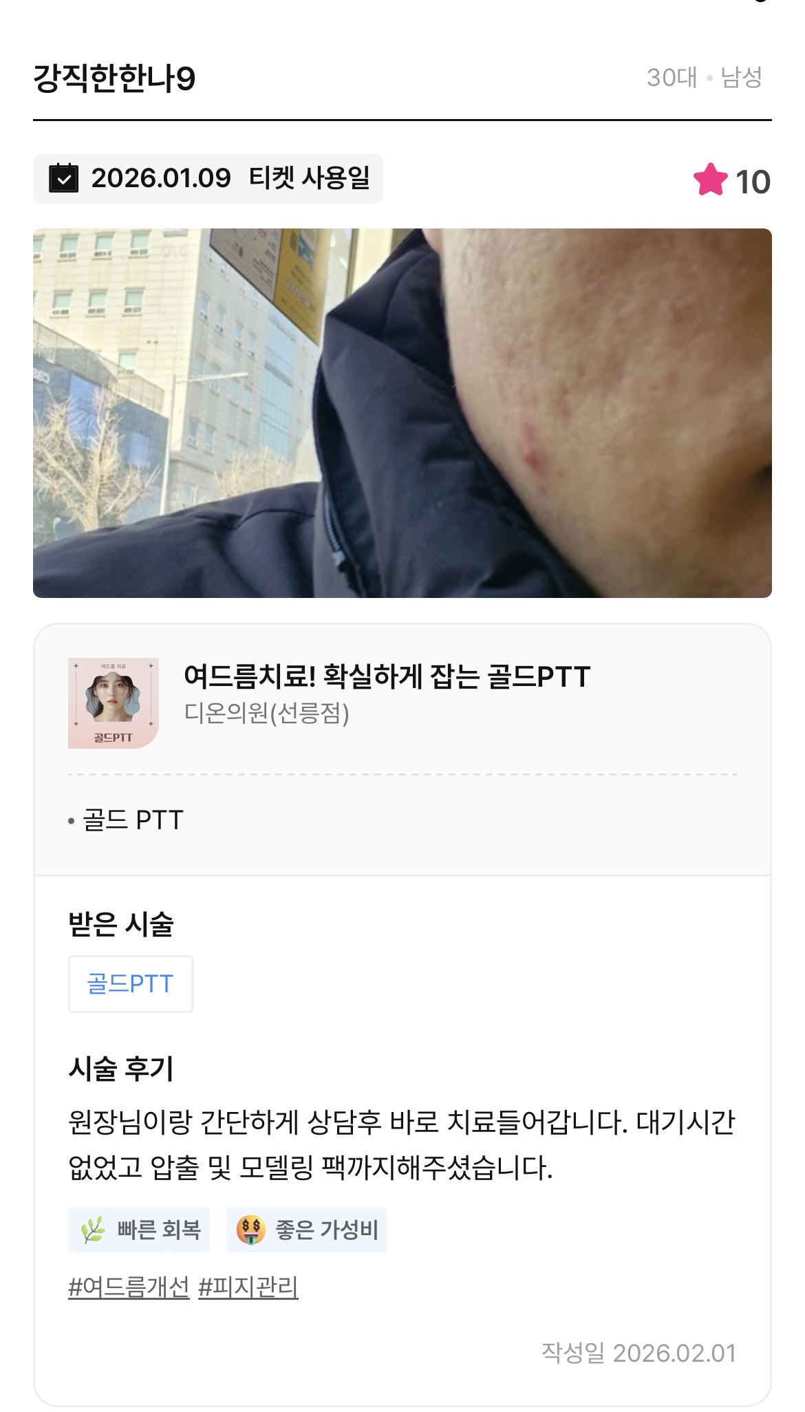 Review - 디온의원 선릉점 3