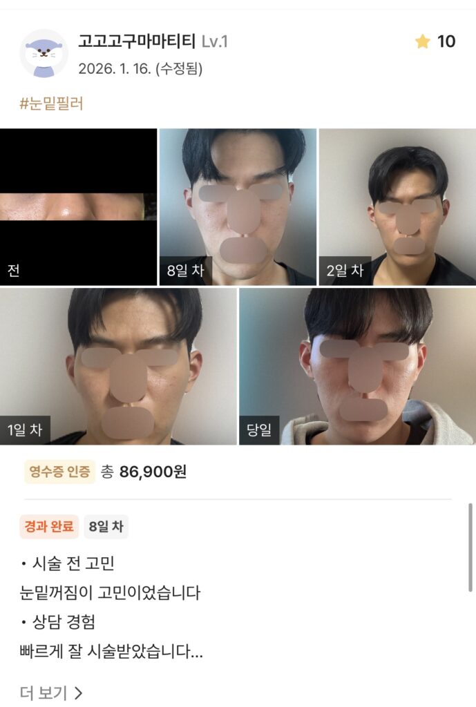 Coming soon - 디온의원 선릉점 5