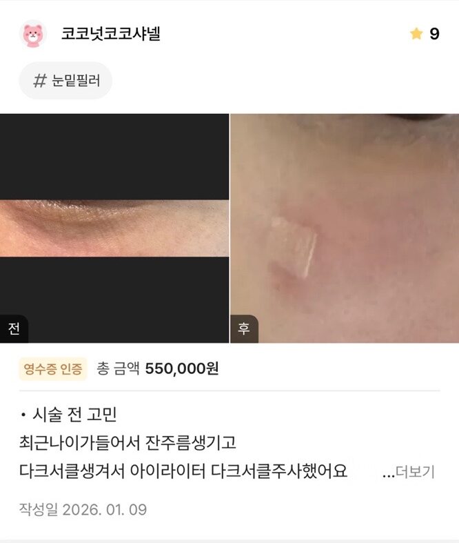 Review - 디온의원 선릉점 4