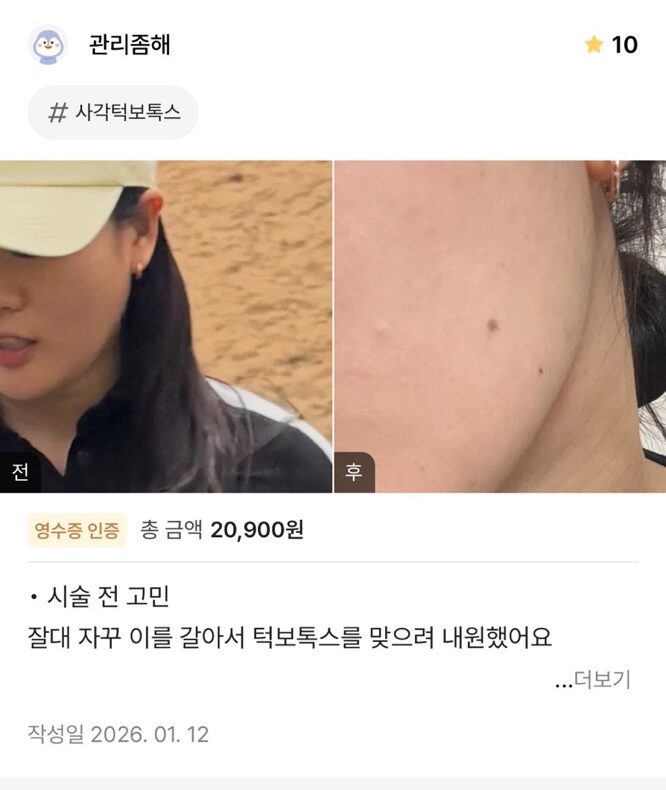 Review - 디온의원 선릉점 5