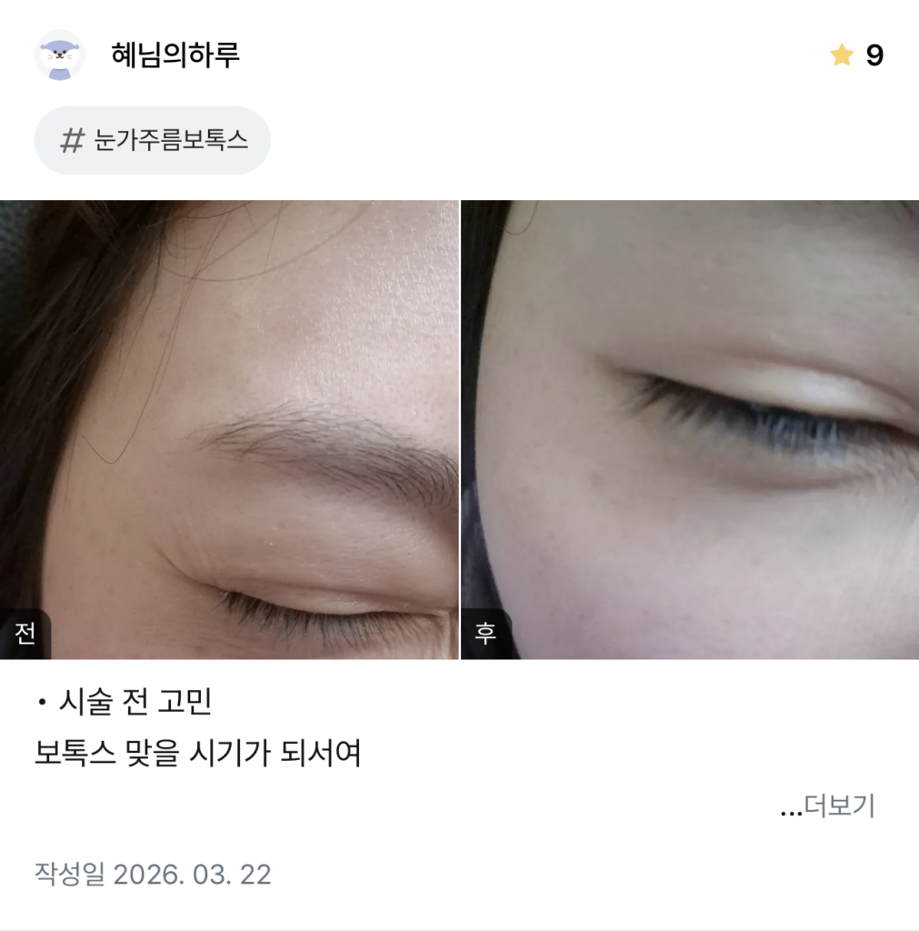 KakaoTalk 20260404 132421293 01 - 디온의원 선릉점