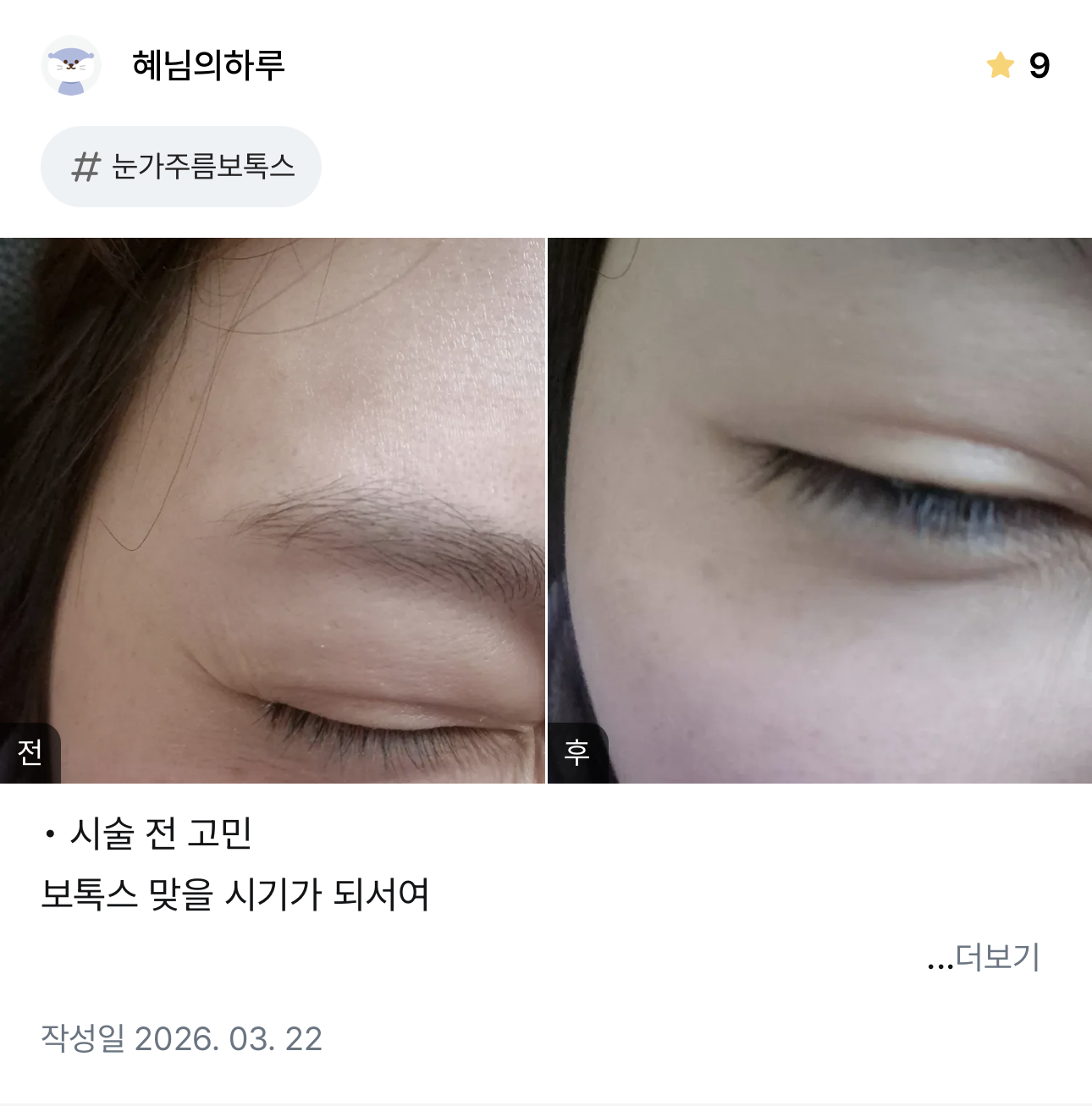KakaoTalk 20260404 132421293 01 - 디온의원 선릉점