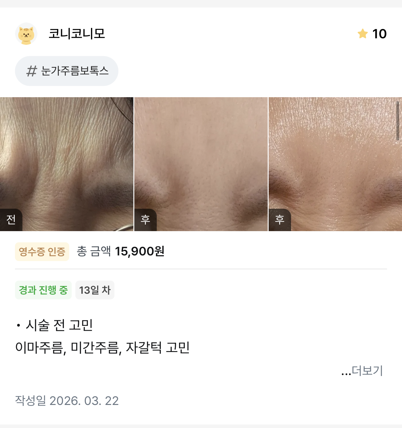 KakaoTalk 20260404 132421293 03 - 디온의원 선릉점